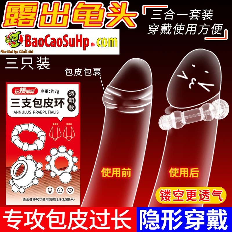 Bộ vòng đeo bi lớn Anulus Praeputialis tăng cường bền bỉ